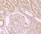 Diaphanous Related Formin 3 antibody, NBP2-80419, Novus Biologicals, Immunohistochemistry paraffin image 