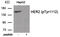 ERBB2 antibody, 79-955, ProSci, Western Blot image 