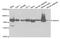 Hydroxyacyl-CoA Dehydrogenase Trifunctional Multienzyme Complex Subunit Alpha antibody, PA5-76718, Invitrogen Antibodies, Western Blot image 