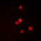 Snail Family Transcriptional Repressor 1 antibody, LS-C368512, Lifespan Biosciences, Immunofluorescence image 