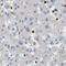 Serpin Family B Member 5 antibody, NBP1-87778, Novus Biologicals, Immunohistochemistry paraffin image 