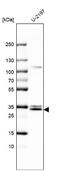 Monoglyceride Lipase antibody, NBP2-55204, Novus Biologicals, Western Blot image 