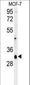 Vesicle Transport Through Interaction With T-SNAREs 1B antibody, LS-C160557, Lifespan Biosciences, Western Blot image 