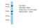 Olfactory Receptor Family 8 Subfamily U Member 8 antibody, A18280, Boster Biological Technology, Western Blot image 