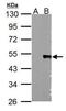 Wnt Family Member 5A antibody, PA5-27230, Invitrogen Antibodies, Western Blot image 