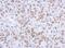 Lamin A/C antibody, NBP2-19324, Novus Biologicals, Immunohistochemistry paraffin image 