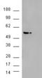 AKT Serine/Threonine Kinase 3 antibody, EB06562, Everest Biotech, Western Blot image 