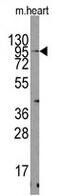 Transient Receptor Potential Cation Channel Subfamily V Member 3 antibody, AP11388PU-N, Origene, Western Blot image 