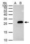 PTTG1 Regulator Of Sister Chromatid Separation, Securin antibody, PA5-29399, Invitrogen Antibodies, Immunoprecipitation image 