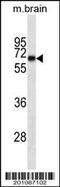 66 kDa neurofilament protein antibody, MBS9200106, MyBioSource, Western Blot image 