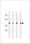 Cdk5 And Abl Enzyme Substrate 2 antibody, TA325162, Origene, Western Blot image 