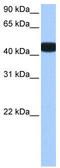 Branched Chain Keto Acid Dehydrogenase Kinase antibody, TA340087, Origene, Western Blot image 