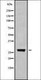 Centromere Protein H antibody, orb337854, Biorbyt, Western Blot image 