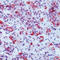 Luteinizing Hormone Beta Polypeptide antibody, LS-C87764, Lifespan Biosciences, Immunohistochemistry frozen image 