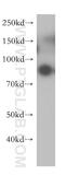 GCSFR antibody, 18310-1-AP, Proteintech Group, Western Blot image 