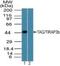 Toll Like Receptor Adaptor Molecule 2 antibody, PA5-23396, Invitrogen Antibodies, Western Blot image 