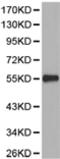 Serine/threonine-protein phosphatase 2A 55 kDa regulatory subunit B alpha isoform antibody, TA324040, Origene, Western Blot image 