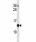 CDKN2A antibody, F47172-0.4ML, NSJ Bioreagents, Western Blot image 