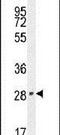 Vestigial Like Family Member 2 antibody, PA5-24311, Invitrogen Antibodies, Western Blot image 