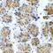 Somatostatin Receptor 2 antibody, LS-C332379, Lifespan Biosciences, Immunohistochemistry paraffin image 