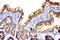 Junction Plakoglobin antibody, PB9185, Boster Biological Technology, Immunohistochemistry paraffin image 