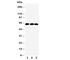 SMAD Family Member 4 antibody, R31056, NSJ Bioreagents, Western Blot image 