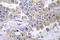 Laminin Subunit Beta 2 antibody, LS-C177176, Lifespan Biosciences, Immunohistochemistry paraffin image 