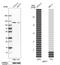 ATP-binding cassette sub-family F member 1 antibody, HPA017578, Atlas Antibodies, Western Blot image 