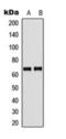 Guanylate Binding Protein 5 antibody, orb393294, Biorbyt, Western Blot image 