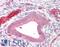 ADA33 antibody, LS-B8901, Lifespan Biosciences, Immunohistochemistry paraffin image 