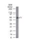 Tumor Protein P73 antibody, NB100-56674, Novus Biologicals, Western Blot image 