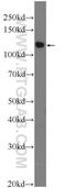 TSC22 Domain Family Member 2 antibody, 25418-1-AP, Proteintech Group, Western Blot image 