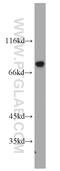 Protein Kinase C Alpha antibody, 21991-1-AP, Proteintech Group, Western Blot image 
