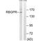 RAB3 GTPase Activating Non-Catalytic Protein Subunit 2 antibody, A07244, Boster Biological Technology, Western Blot image 