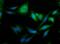 Perilipin 2 antibody, NB110-40877, Novus Biologicals, Immunofluorescence image 