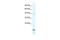 Purinergic Receptor P2X 6 antibody, GTX47685, GeneTex, Western Blot image 