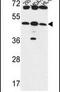 UDP-GlcNAc:BetaGal Beta-1,3-N-Acetylglucosaminyltransferase 5 antibody, PA5-26653, Invitrogen Antibodies, Western Blot image 