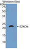 Laminin Subunit Alpha 1 antibody, LS-C295075, Lifespan Biosciences, Western Blot image 