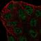 ATP Binding Cassette Subfamily A Member 6 antibody, PA5-66731, Invitrogen Antibodies, Immunofluorescence image 