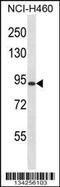 Regulator Of G Protein Signaling 9 antibody, 57-580, ProSci, Western Blot image 