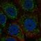 Zinc Finger HIT-Type Containing 3 antibody, HPA060019, Atlas Antibodies, Immunofluorescence image 