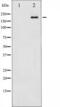 TSC Complex Subunit 2 antibody, TA325960, Origene, Western Blot image 