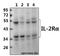 CD25 antibody, GTX66646, GeneTex, Western Blot image 