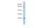 PDGFA Associated Protein 1 antibody, PA5-44938, Invitrogen Antibodies, Western Blot image 