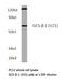 Guanylate cyclase soluble subunit beta-1 antibody, LS-C176053, Lifespan Biosciences, Western Blot image 