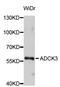 Coenzyme Q8A antibody, LS-C408797, Lifespan Biosciences, Western Blot image 