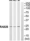 RAB2B, Member RAS Oncogene Family antibody, TA312640, Origene, Western Blot image 