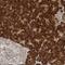 Ribophorin II antibody, NBP1-80835, Novus Biologicals, Immunohistochemistry frozen image 