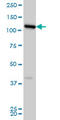 VPS50 Subunit Of EARP/GARPII Complex antibody, LS-C105155, Lifespan Biosciences, Western Blot image 