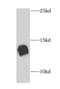 NEDD8 Ubiquitin Like Modifier antibody, FNab05647, FineTest, Western Blot image 